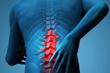 obesitas-sebabkan-nyeri-tulang-belakang-5y0