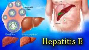 hepatitis-B-1