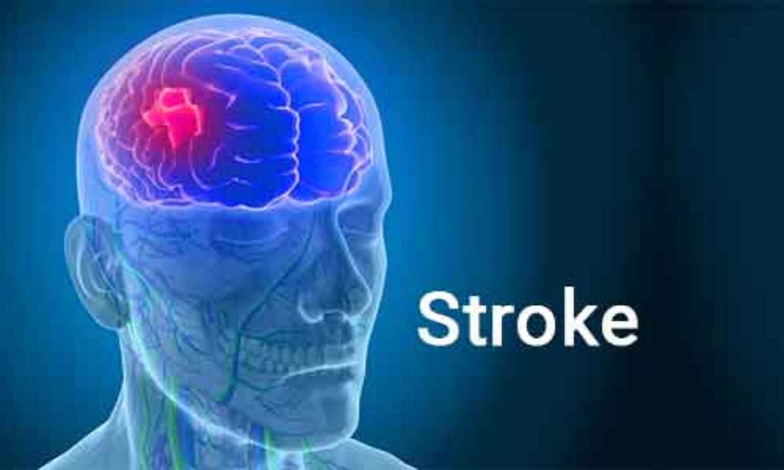 1600x960_124545-stroke-1