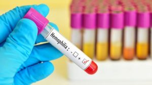 34064-ilustrasi-hemofilia
