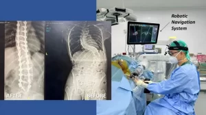 31285-dr-asrafi-rizki-gatam-spot-k-spine