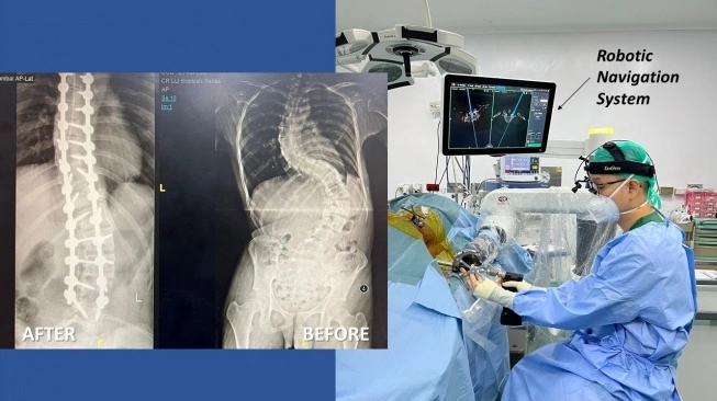 31285-dr-asrafi-rizki-gatam-spot-k-spine