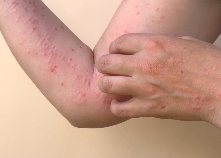 1e2ebd54-c2c0-42a8-837f-e693a3ef80a8-750x536