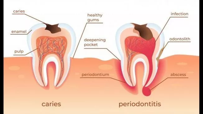 86670-gigi-berlubang-dokenvato